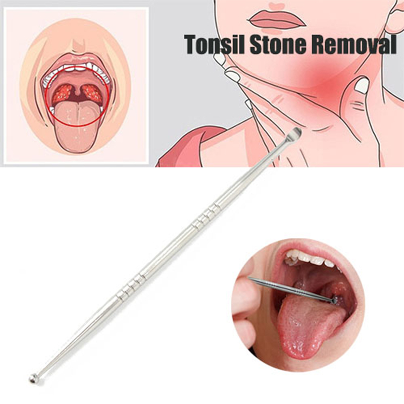 Ear Wax Remover - 1 pièce Outil de nettoyage buccal