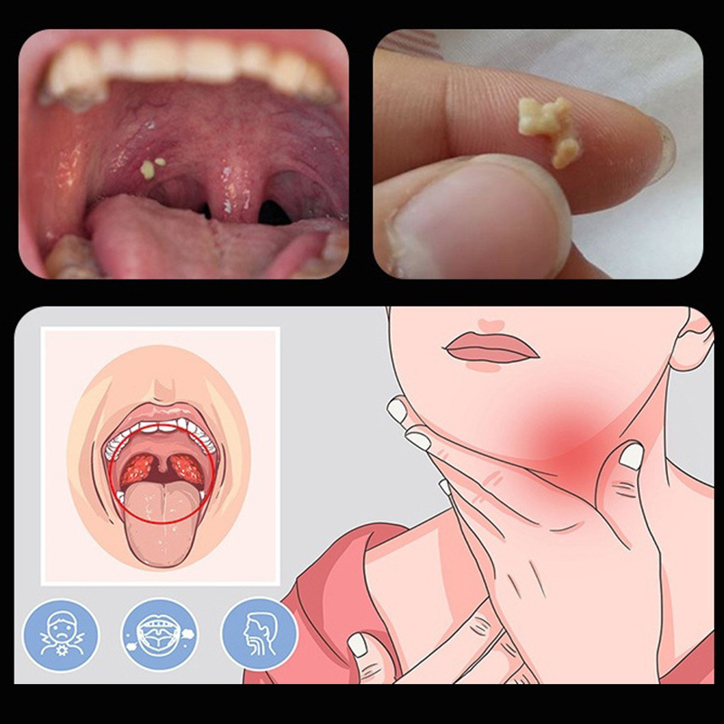 Outil de nettoyage des oreille - Ear Wax Remover avis et prix